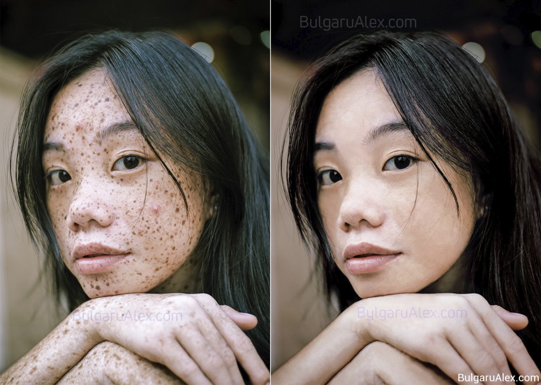 Any photo imperfection retouching - model retouching. Photographer: Ike Louie Natividad - Pexels